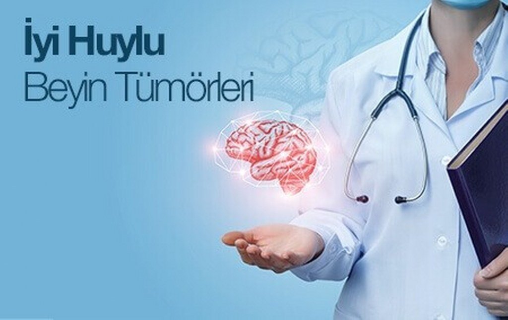 İyi Huylu Beyin Tümörleri: Tanım, Türler, Belirtiler ve Tedavi Yöntemleri