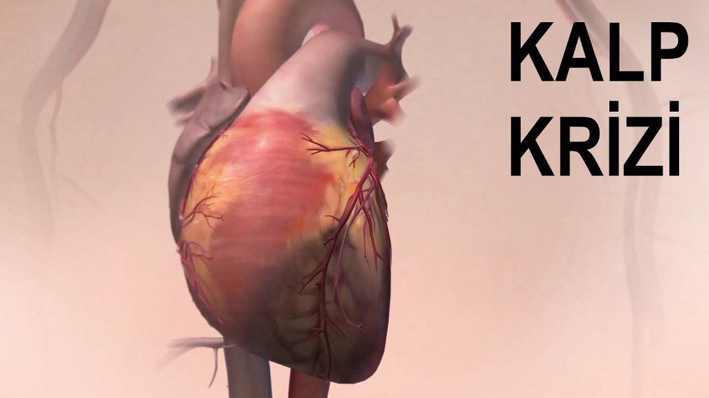 Kalp Krizi Nedir? Kalp Krizi Belirtileri Nelerdir?