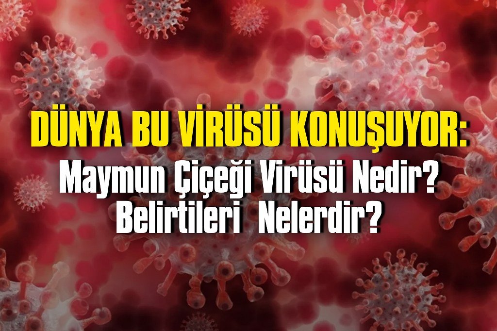 Maymun Çiçeği Virüsü Nedir? Belirtileri ve Tedavisi