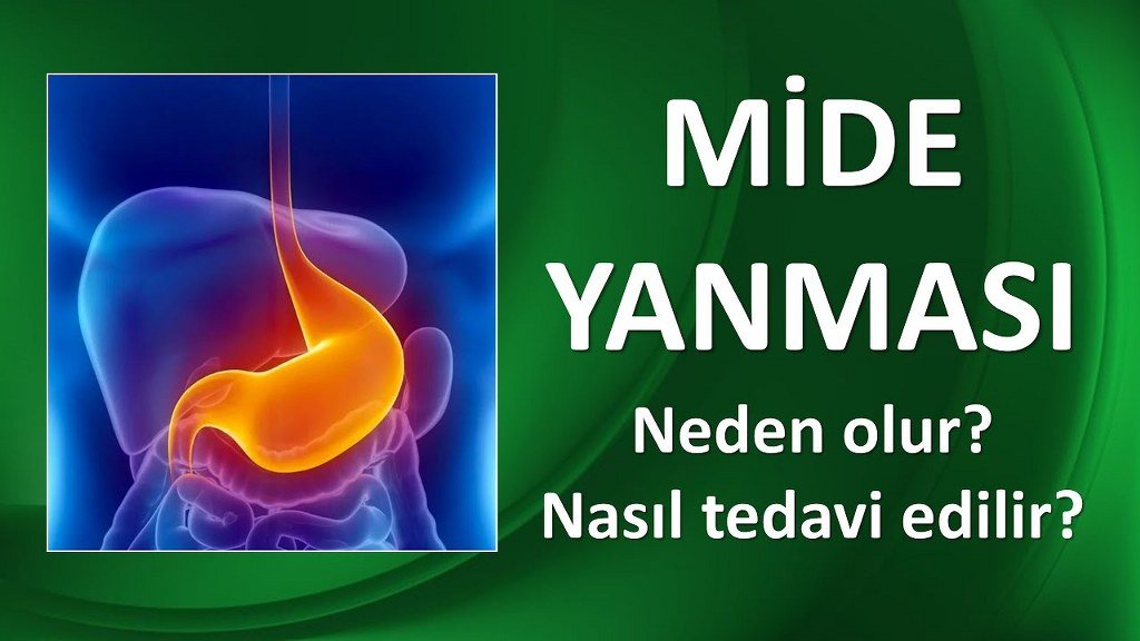 Mide Yanması Nedir? Neden Olur? Tedavi Yöntemleri